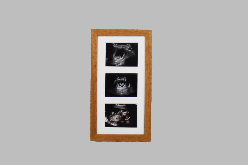 Baby Scan Photo Frame - Multi aperture Frame for Three Scan sized Photos.  Handmade. Baby Shower Gift | Pregnancy Announcement